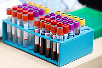 В рамках акции БКК \"Сила волонтерского сердца\" уже сдали кровь почти 1600 волонтеров