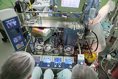 Белорусские кардиохирурги выполнили малышу уникальную высокотехнологичную операцию