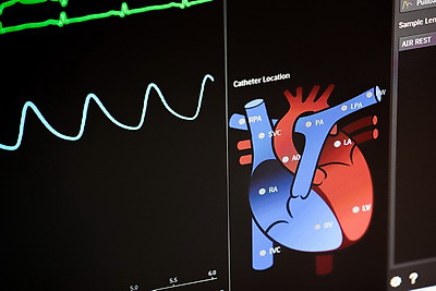 Белорусские кардиохирурги выполнили малышу уникальную высокотехнологичную операцию